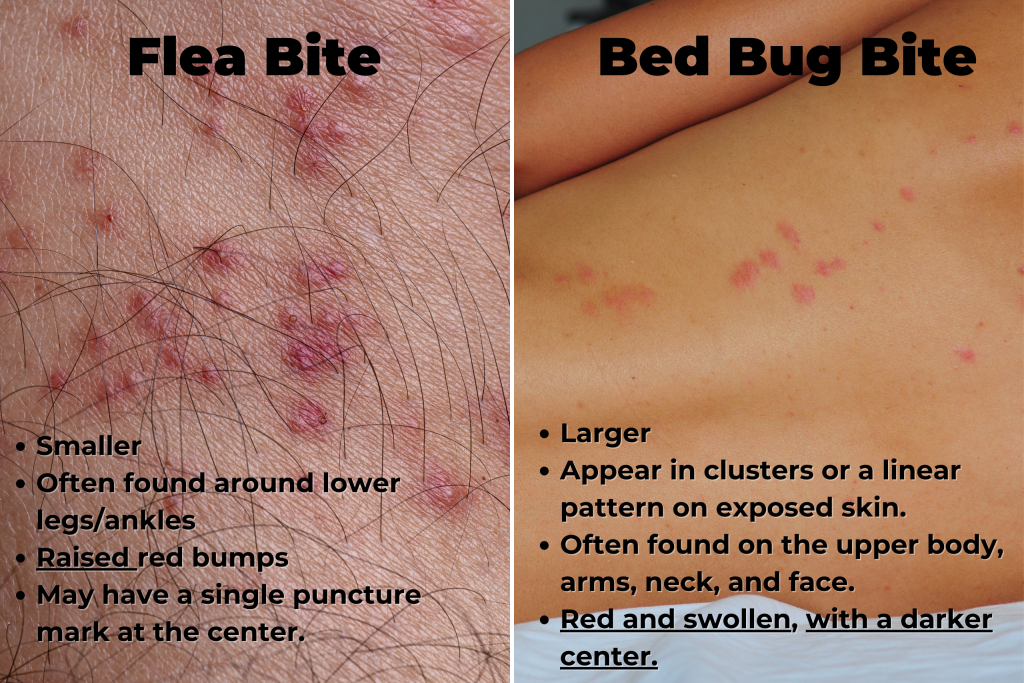 Do Bed Bug Bites Have A Head