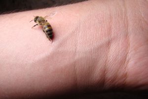 picture of a honey bee stinging an adult arm